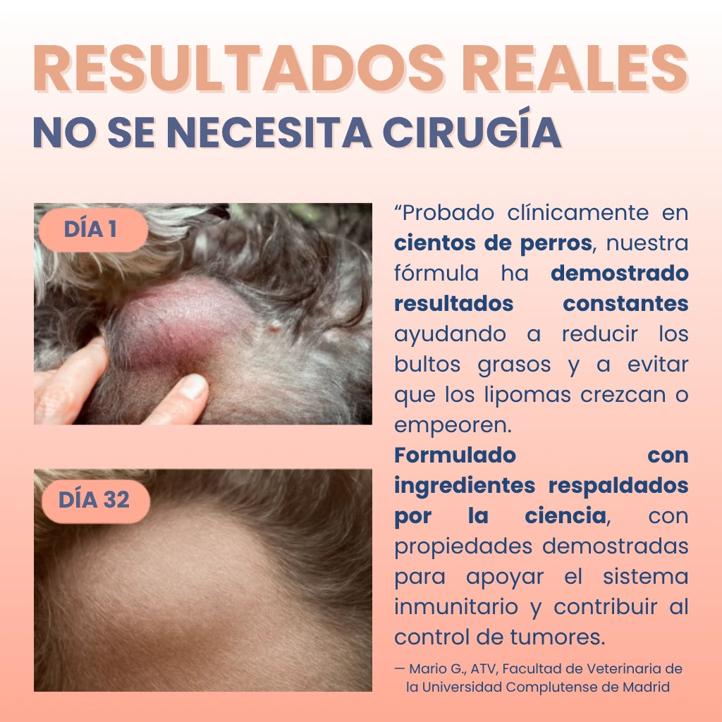 Lura Lipox™ - Frena los lipomas desde dentro