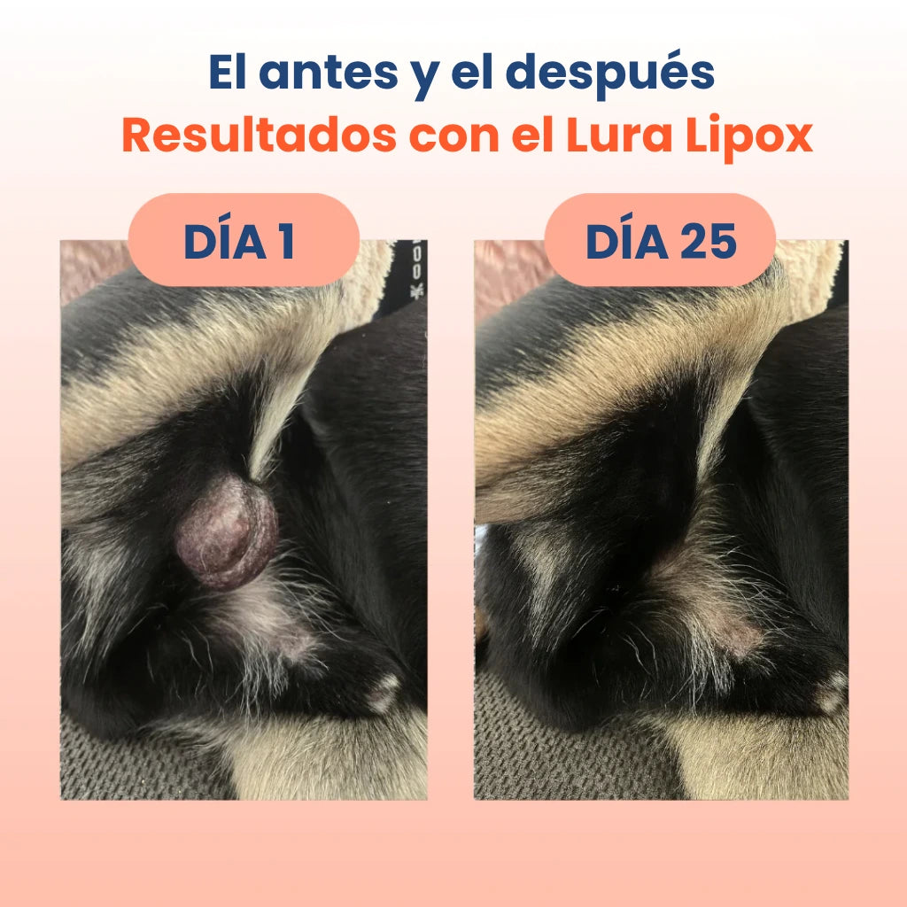 Lura Lipox™ - Frena los lipomas desde dentro