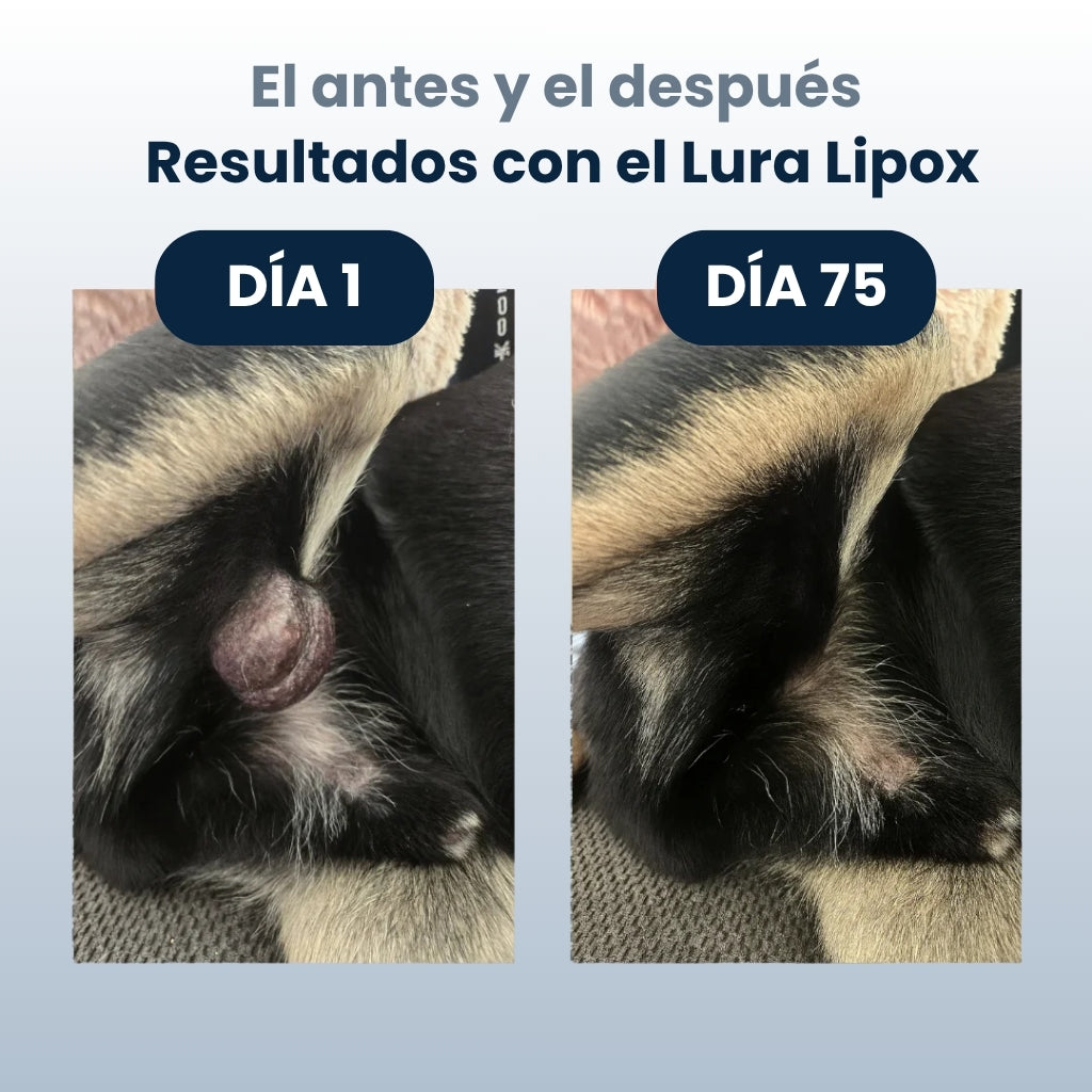 Lura Lipox™ - Frena los lipomas desde dentro