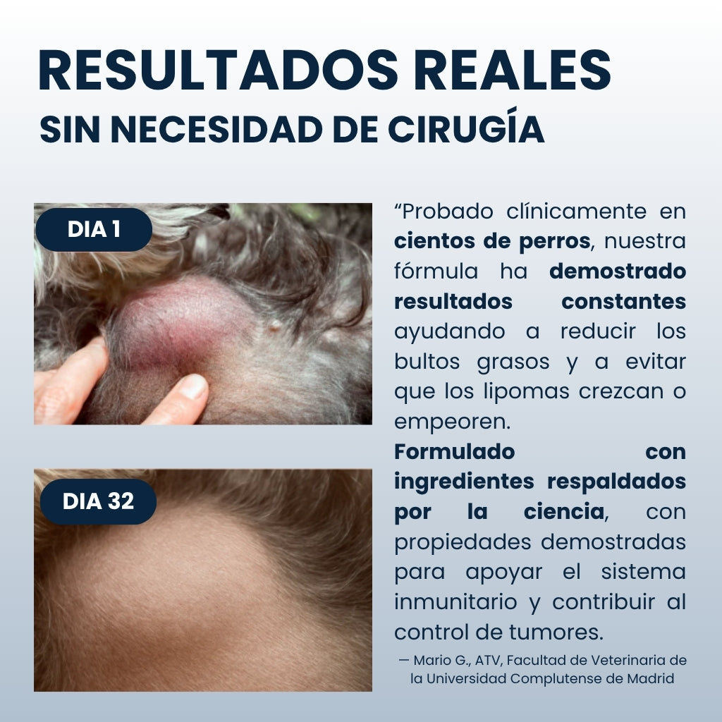 Lura Lipox™ - Frena los lipomas desde dentro